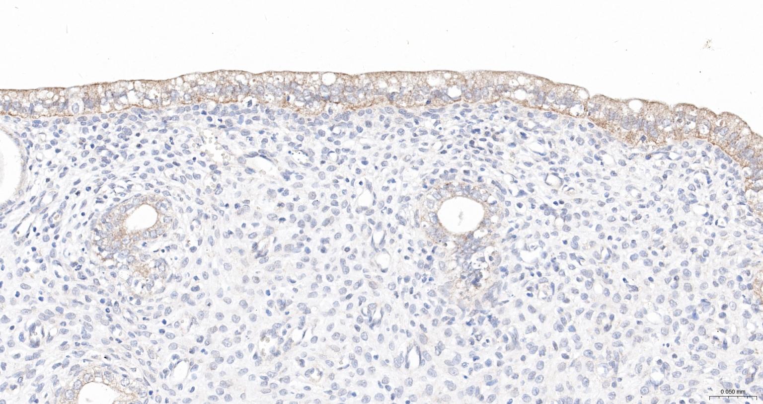 广谱细胞角蛋白PCK抗体