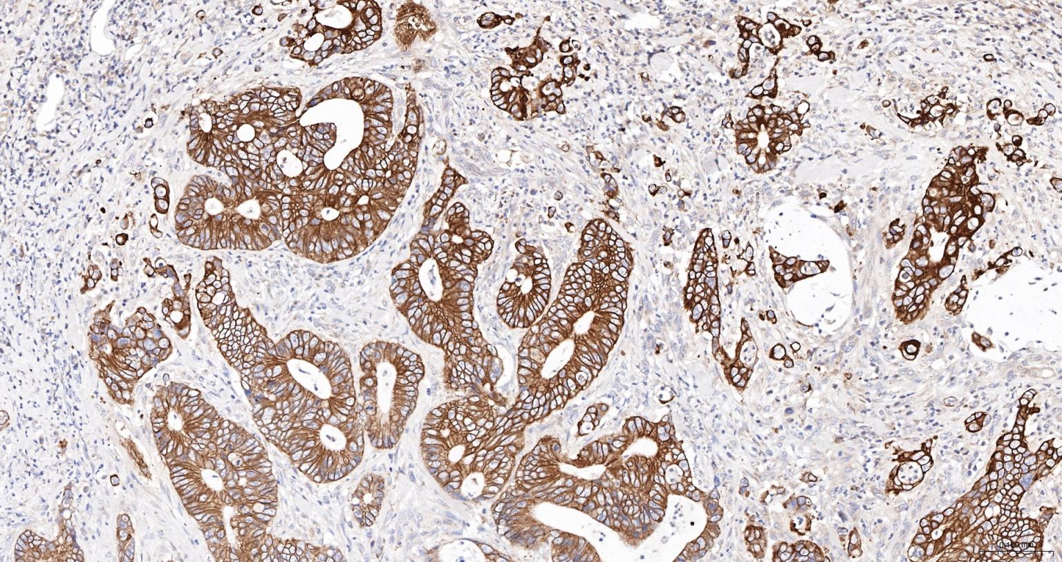 细胞角蛋白18抗体(C端)-bs-1339R