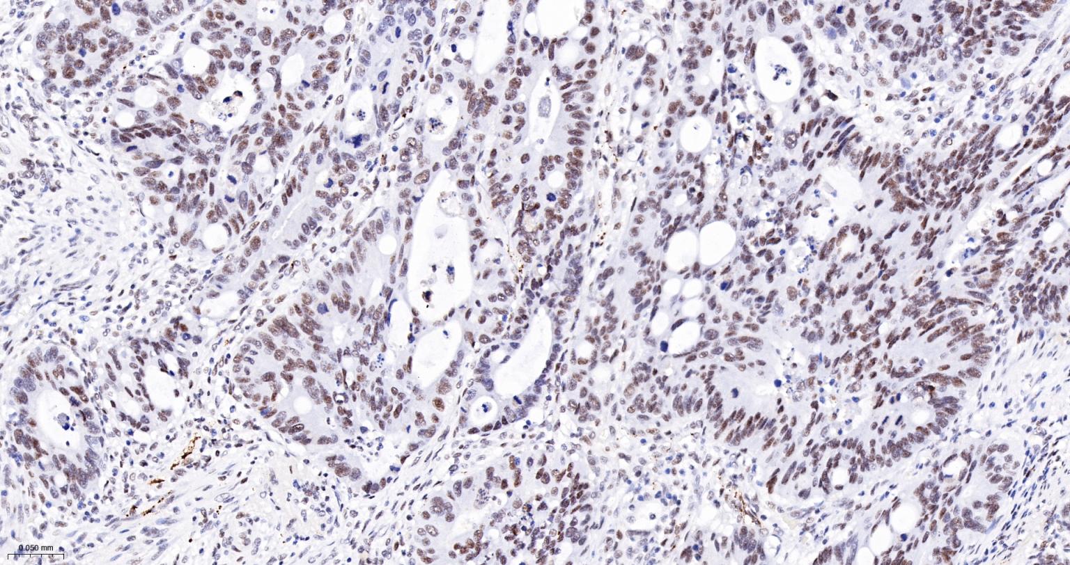 染色体结构维持蛋白质1α重组兔单抗