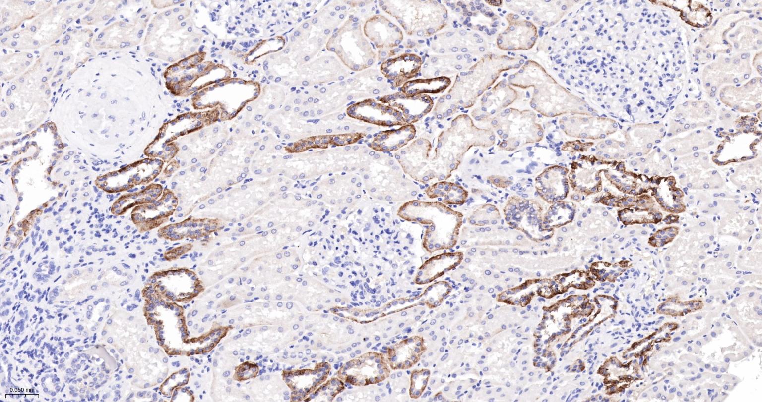 水通道蛋白4重组兔单抗