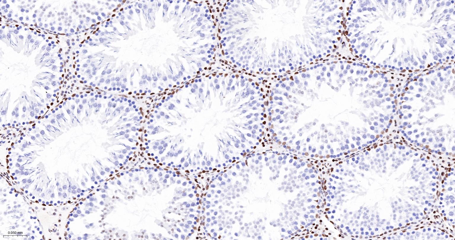 染色体结构维持蛋白质1α重组兔单抗