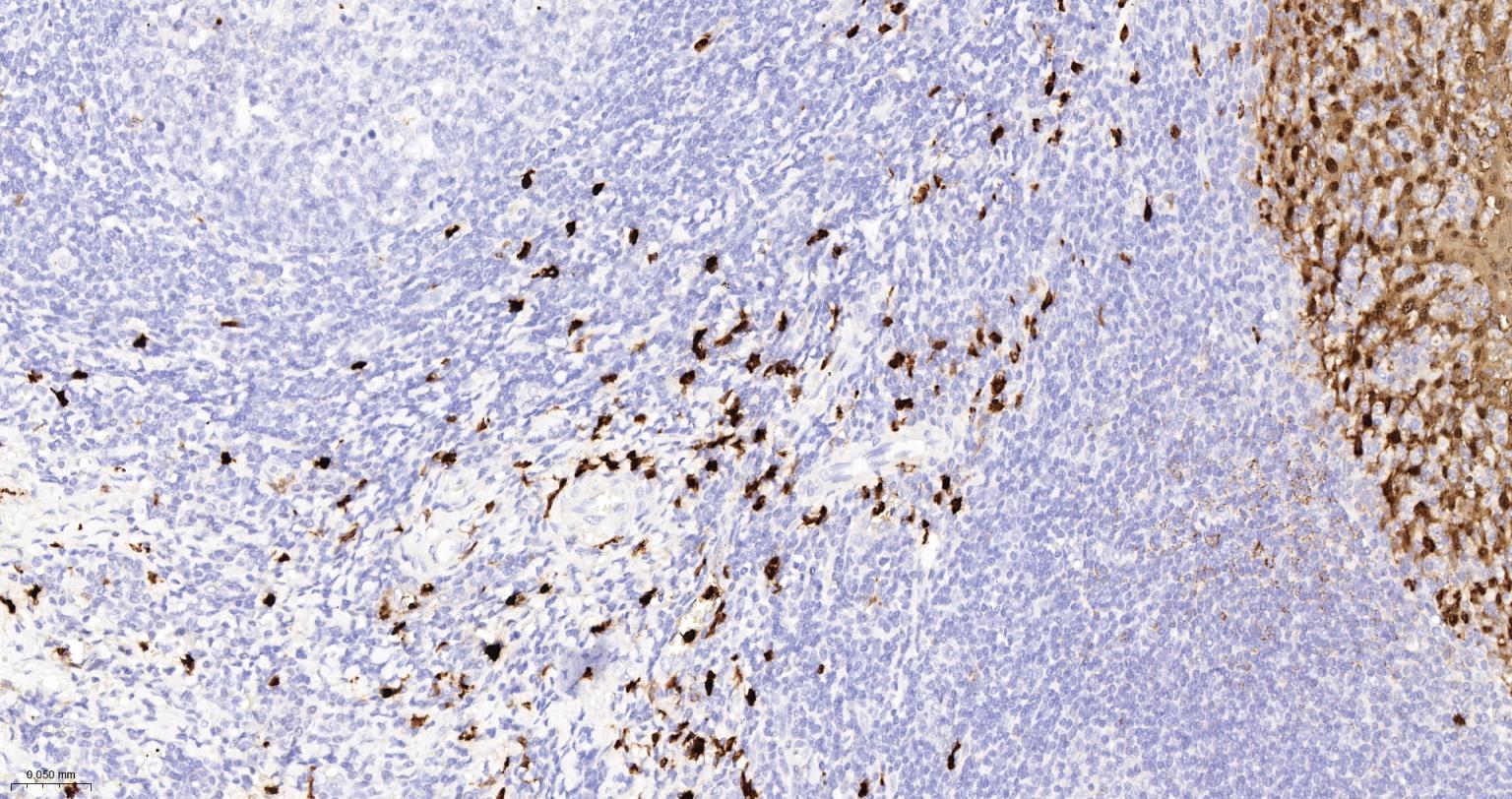 S100钙结合蛋白A8重组兔单抗
