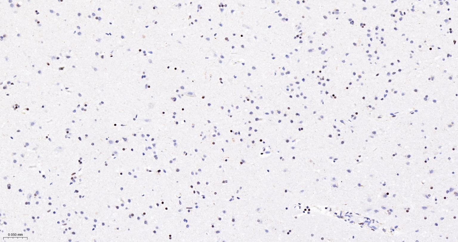 染色体结构维持蛋白质1α重组兔单抗
