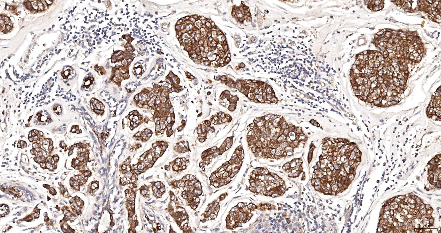 细胞角蛋白18抗体(C端)-bs-1339R