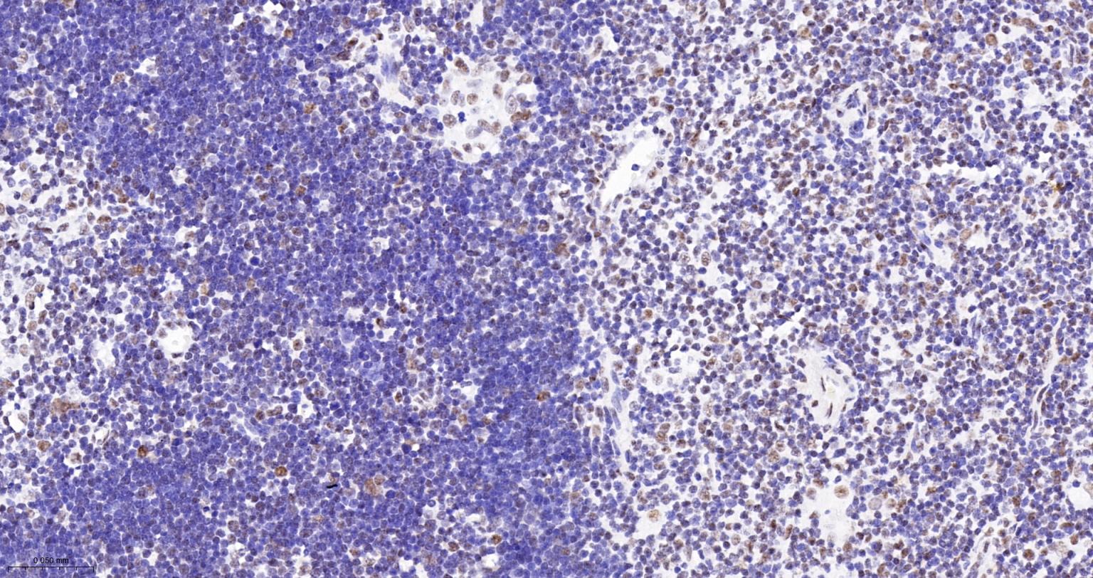 染色体结构维持蛋白质1α重组兔单抗