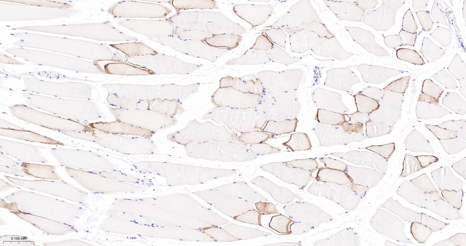 水通道蛋白4重组兔单抗