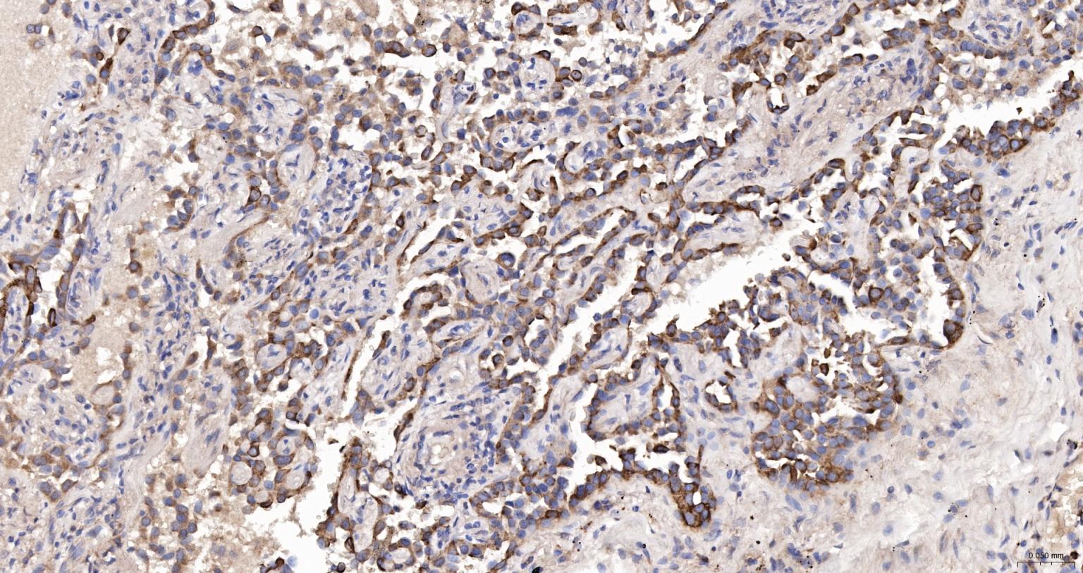 细胞角蛋白18抗体(C端)-bs-1339R