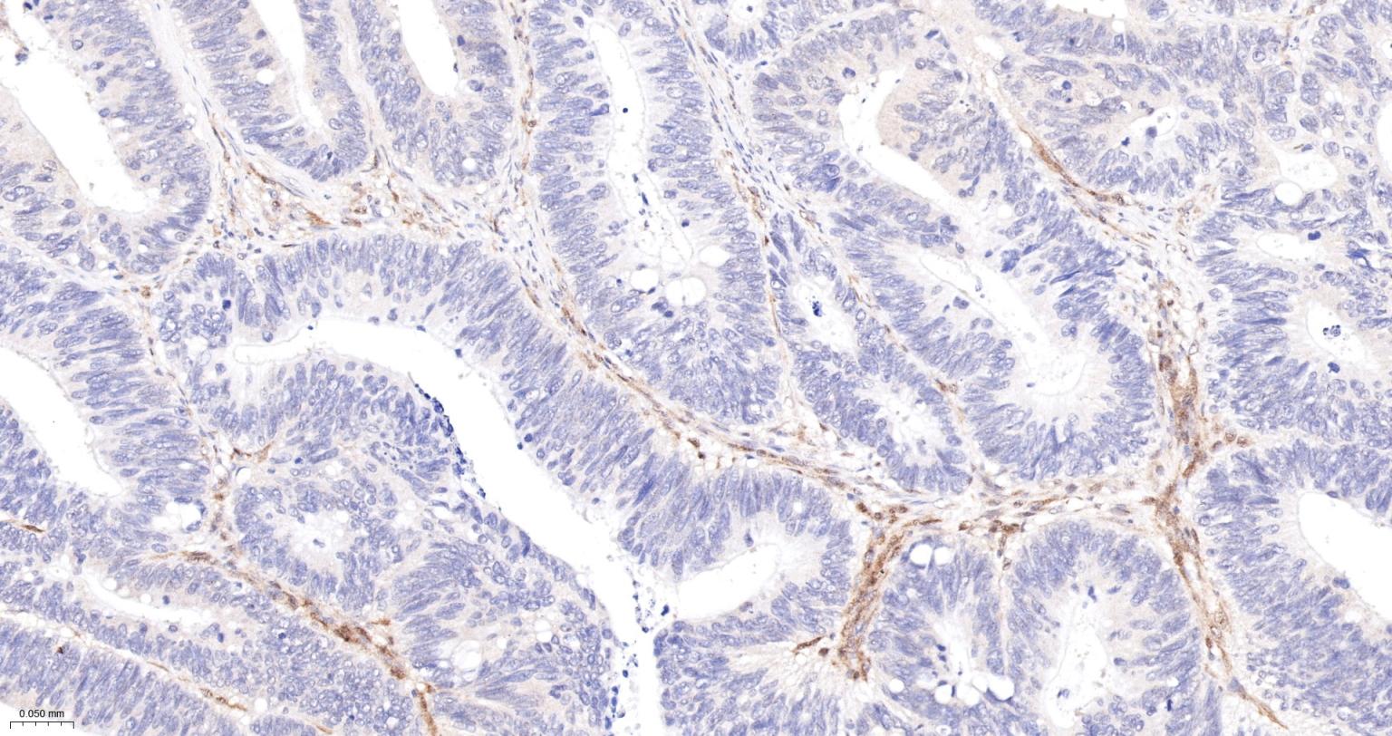 一种肿瘤抑制基因抗体