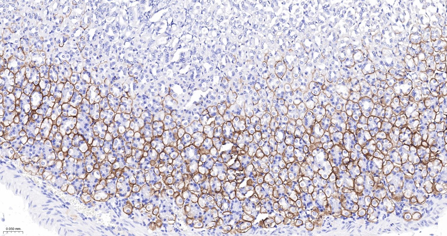 水通道蛋白4重组兔单抗
