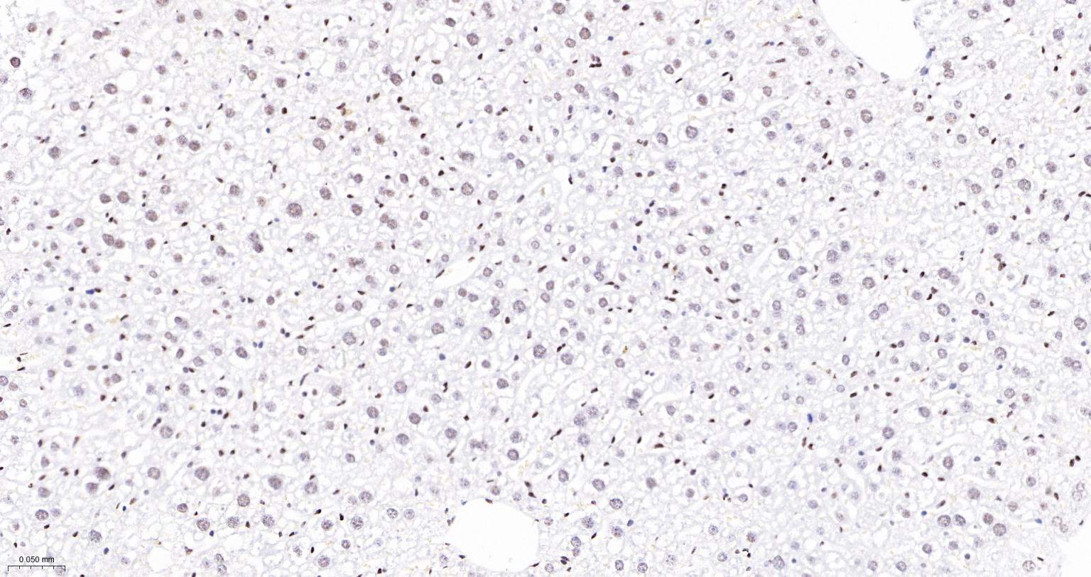 染色体结构维持蛋白质1α重组兔单抗