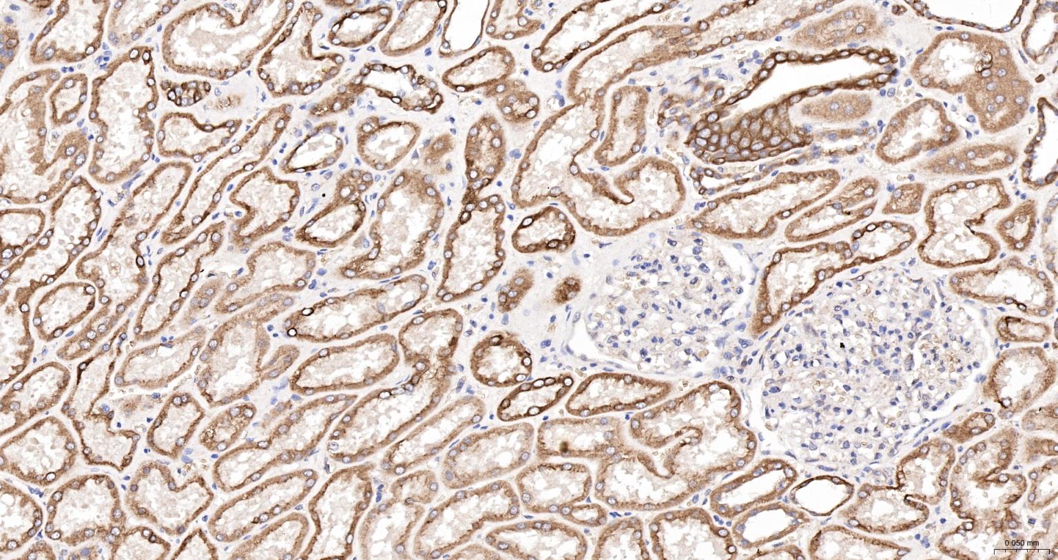 细胞角蛋白18抗体(C端)-bs-1339R