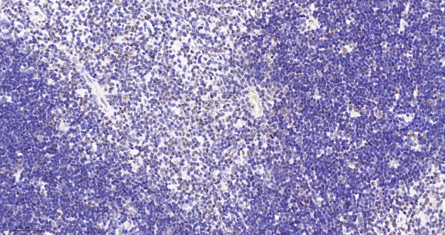 染色体结构维持蛋白质1α重组兔单抗