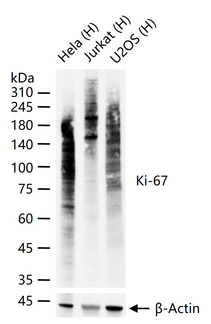 Ki67重组兔单抗