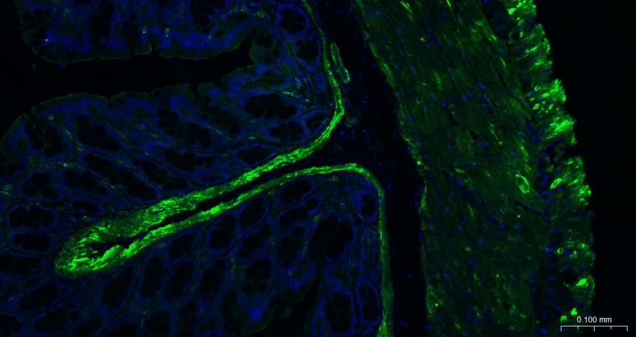 肌动蛋白α/α-SMA/α Actin单克隆抗体-bsm-33187M