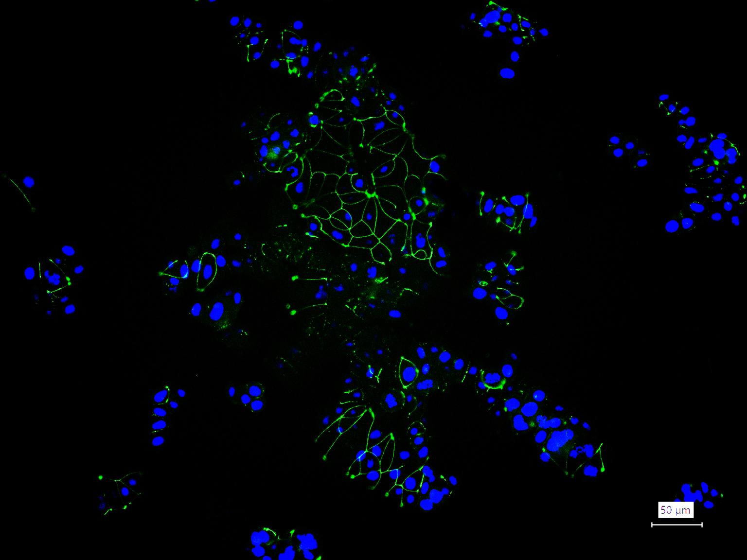 胞质紧密粘连蛋白1/闭锁小带蛋白1重组兔单抗