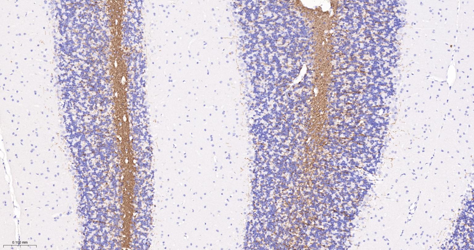 髓鞘碱性蛋白/磷脂碱性蛋白单克隆抗体-bsm-33932M