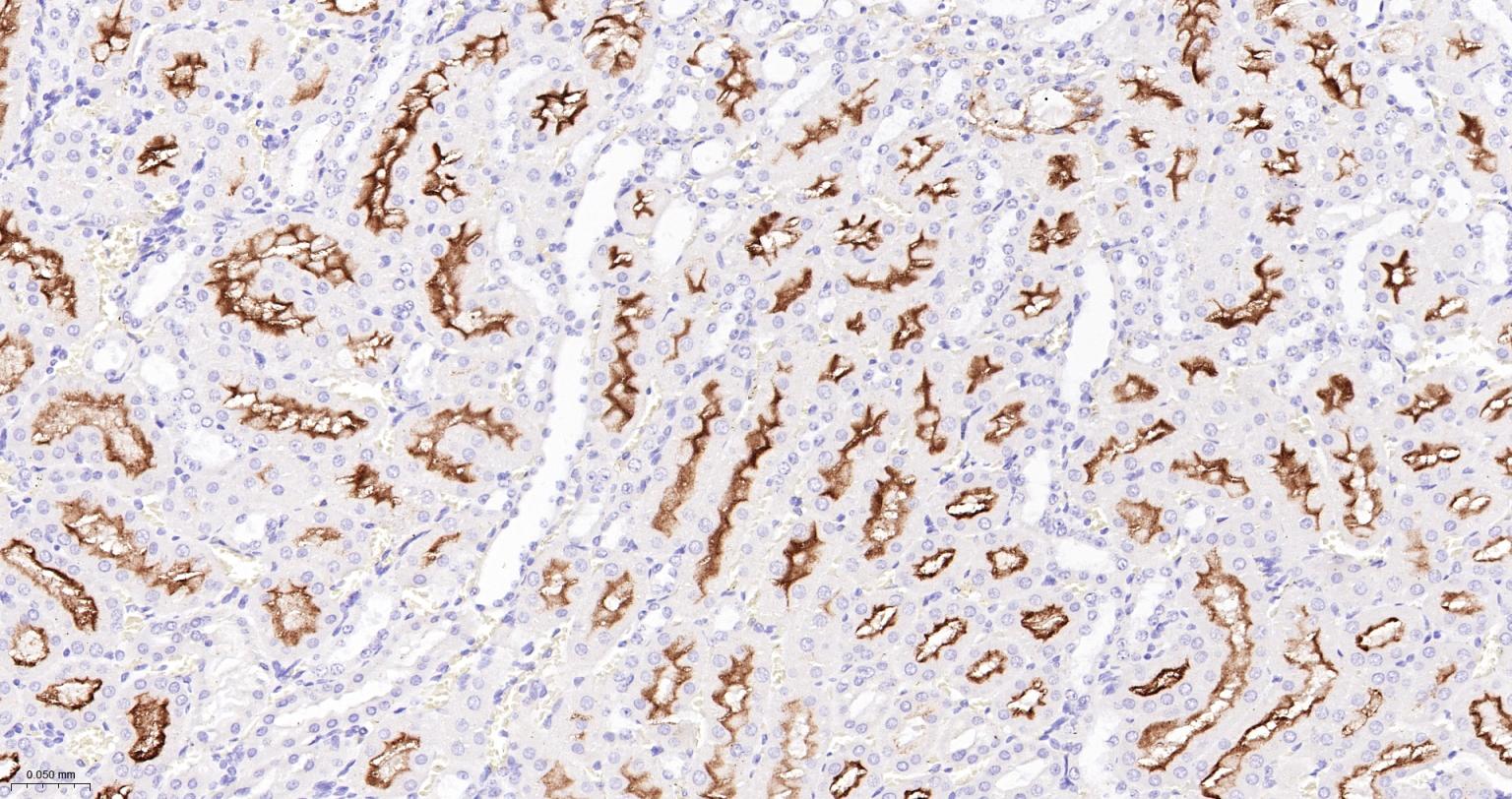 血管紧张素转换酶ACE1重组兔单抗