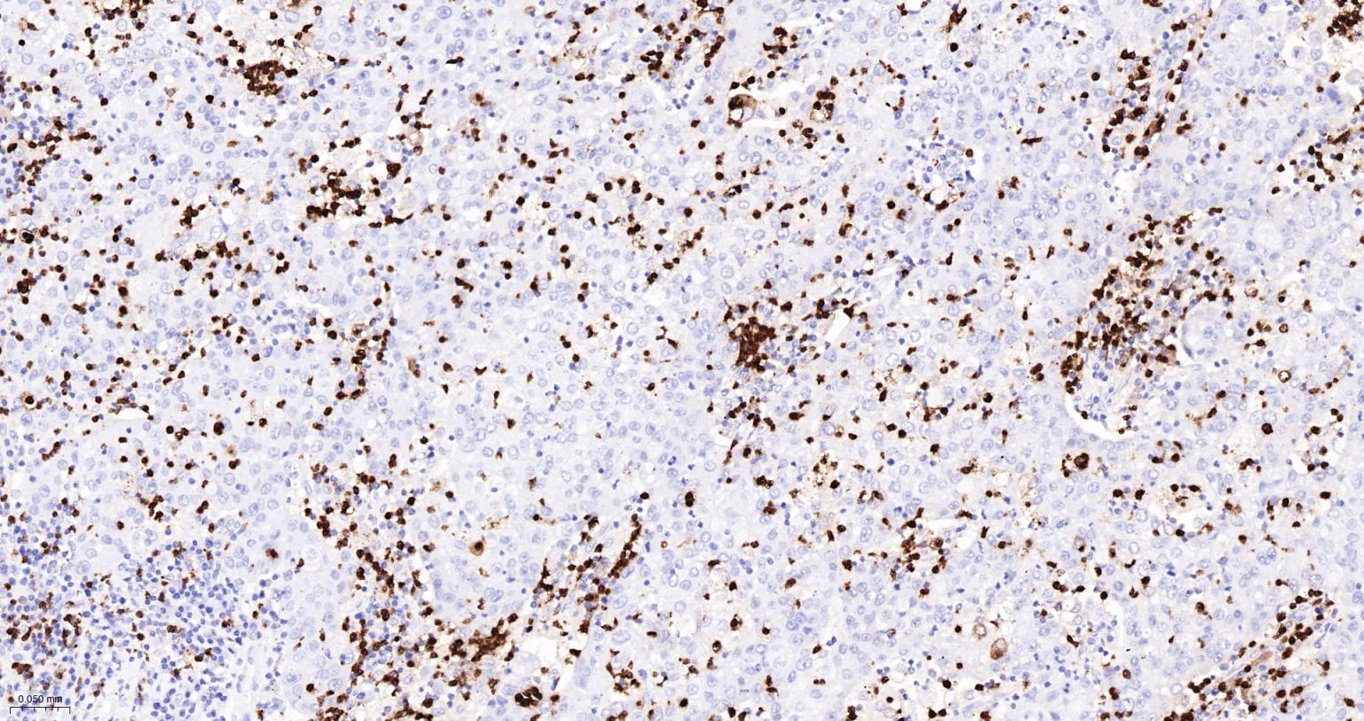 髓过氧化物酶重组兔单抗