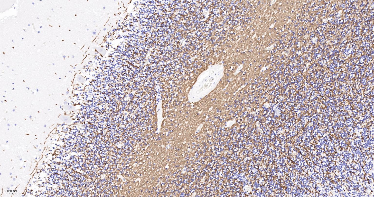 髓鞘碱性蛋白/磷脂碱性蛋白单克隆抗体-bsm-33932M