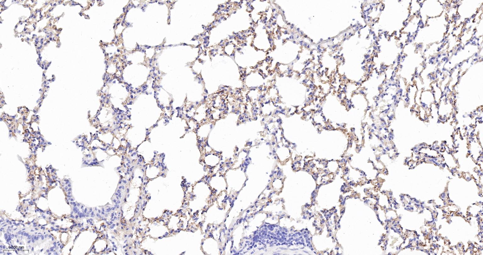 血管紧张素转换酶ACE1重组兔单抗
