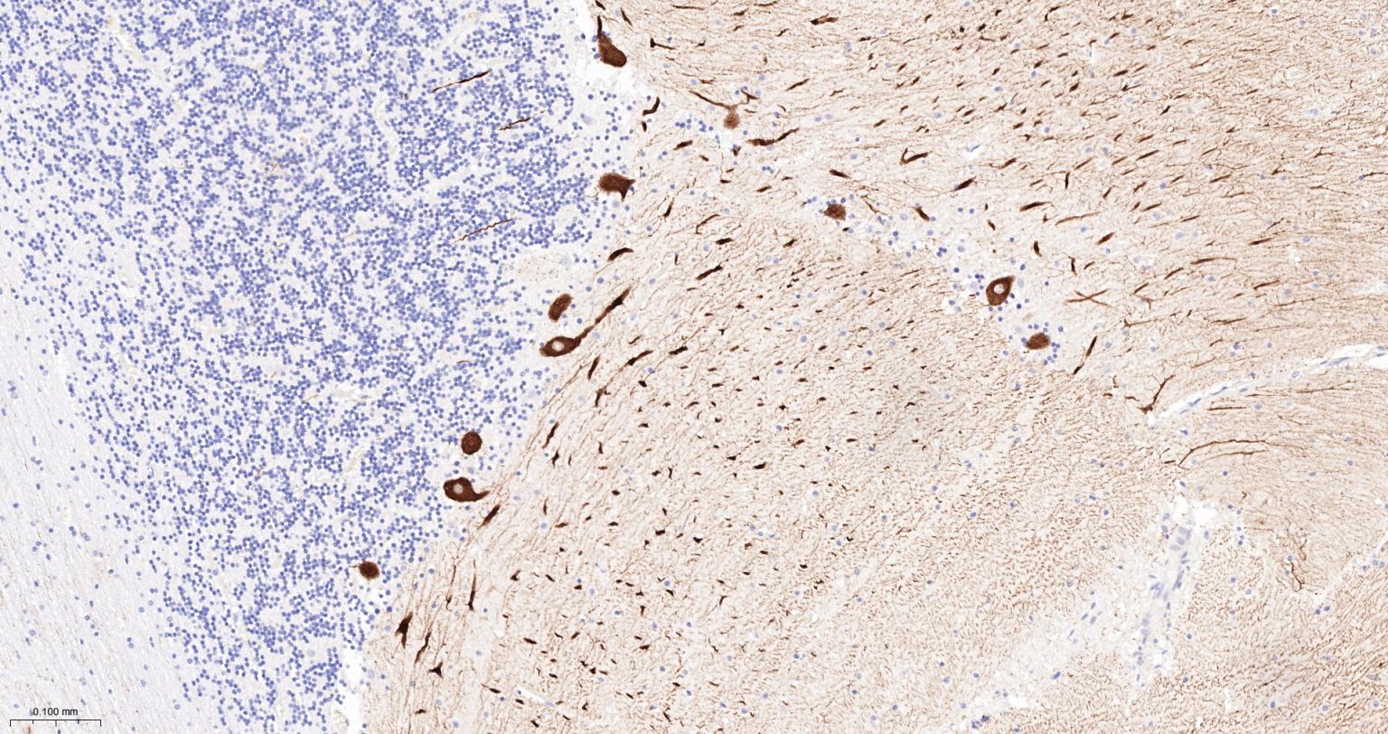 5-三磷酸肌醇受体1重组兔单抗