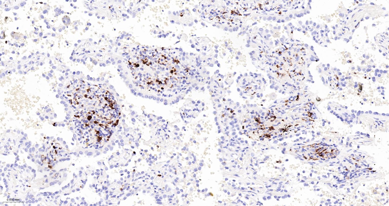 髓过氧化物酶重组兔单抗