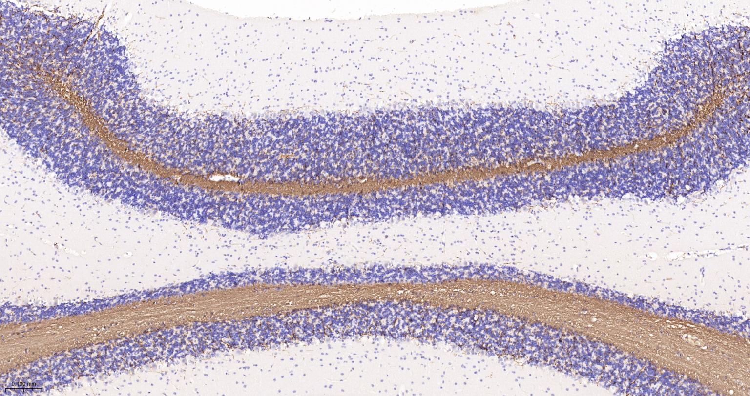 髓鞘碱性蛋白/磷脂碱性蛋白单克隆抗体-bsm-33932M