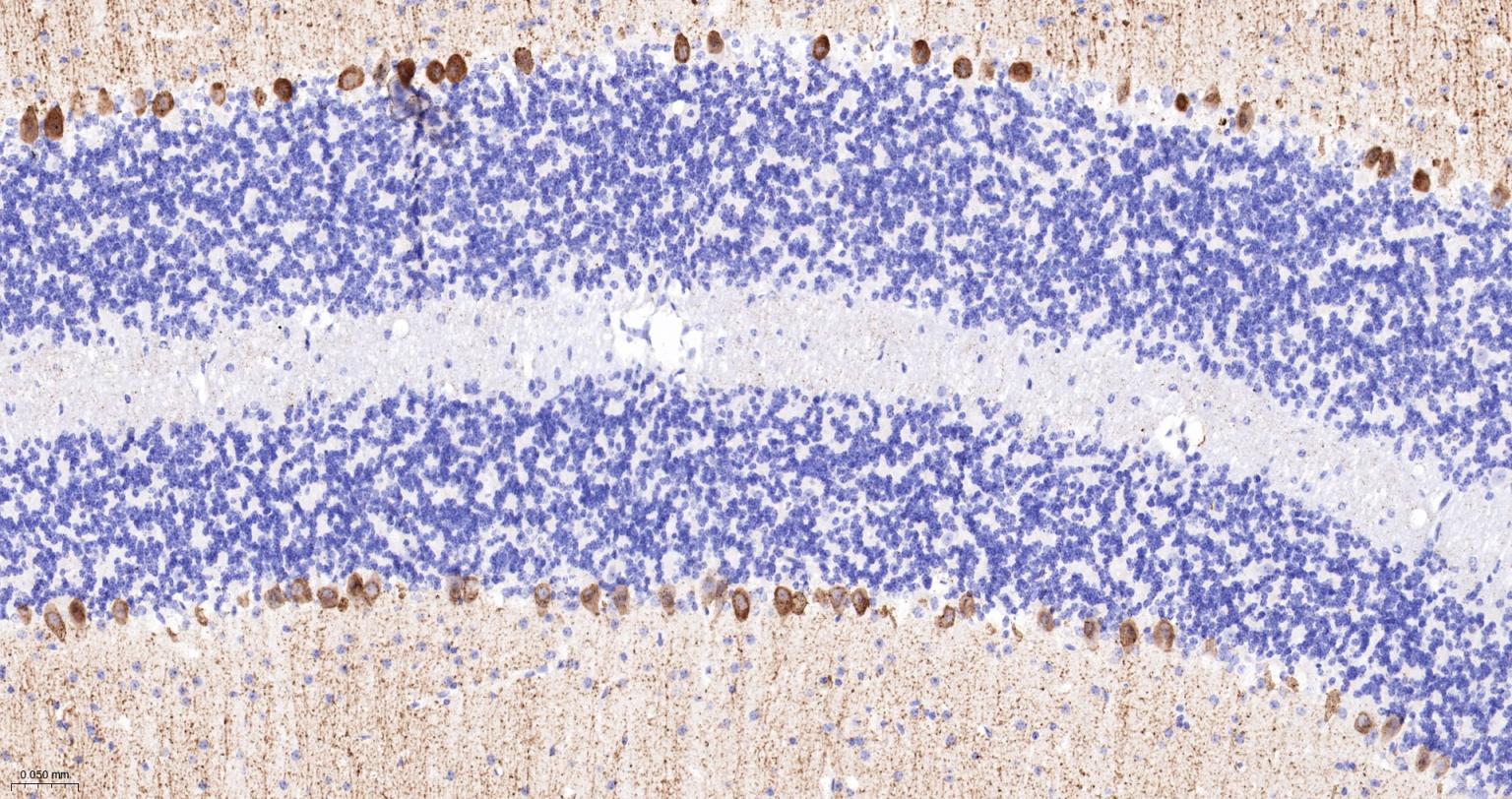 5-三磷酸肌醇受体1重组兔单抗