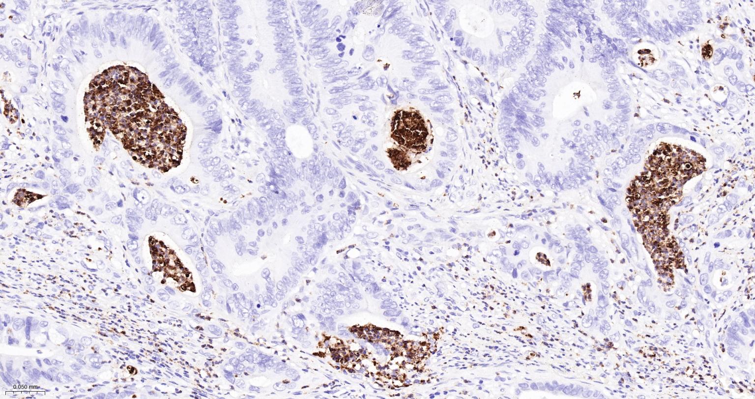 髓过氧化物酶重组兔单抗