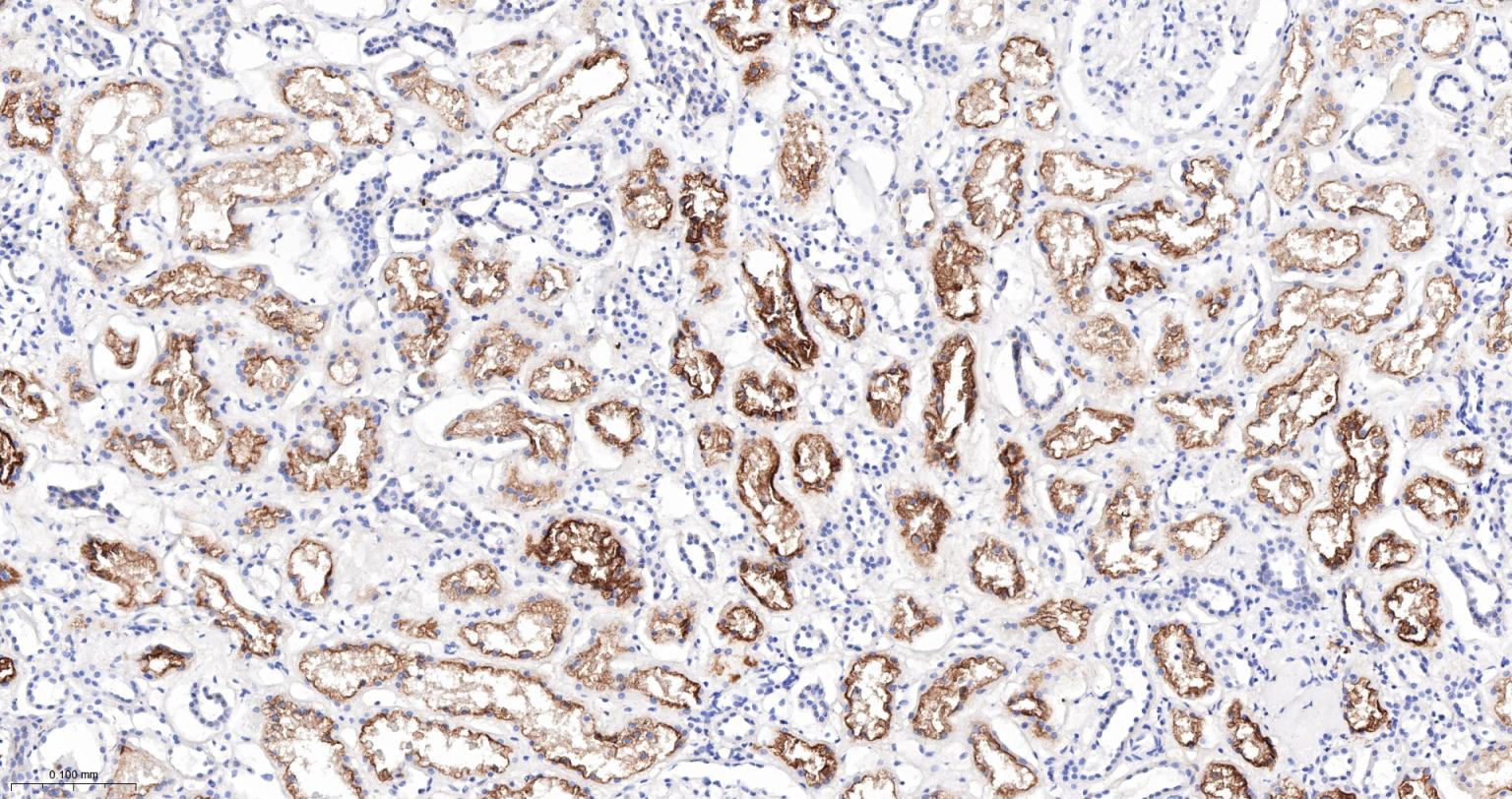 血管紧张素转换酶ACE1重组兔单抗