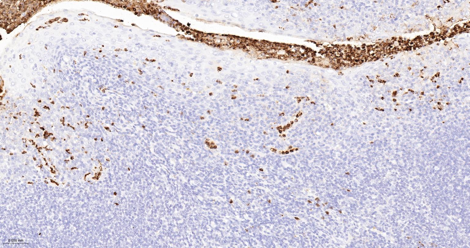 髓过氧化物酶重组兔单抗