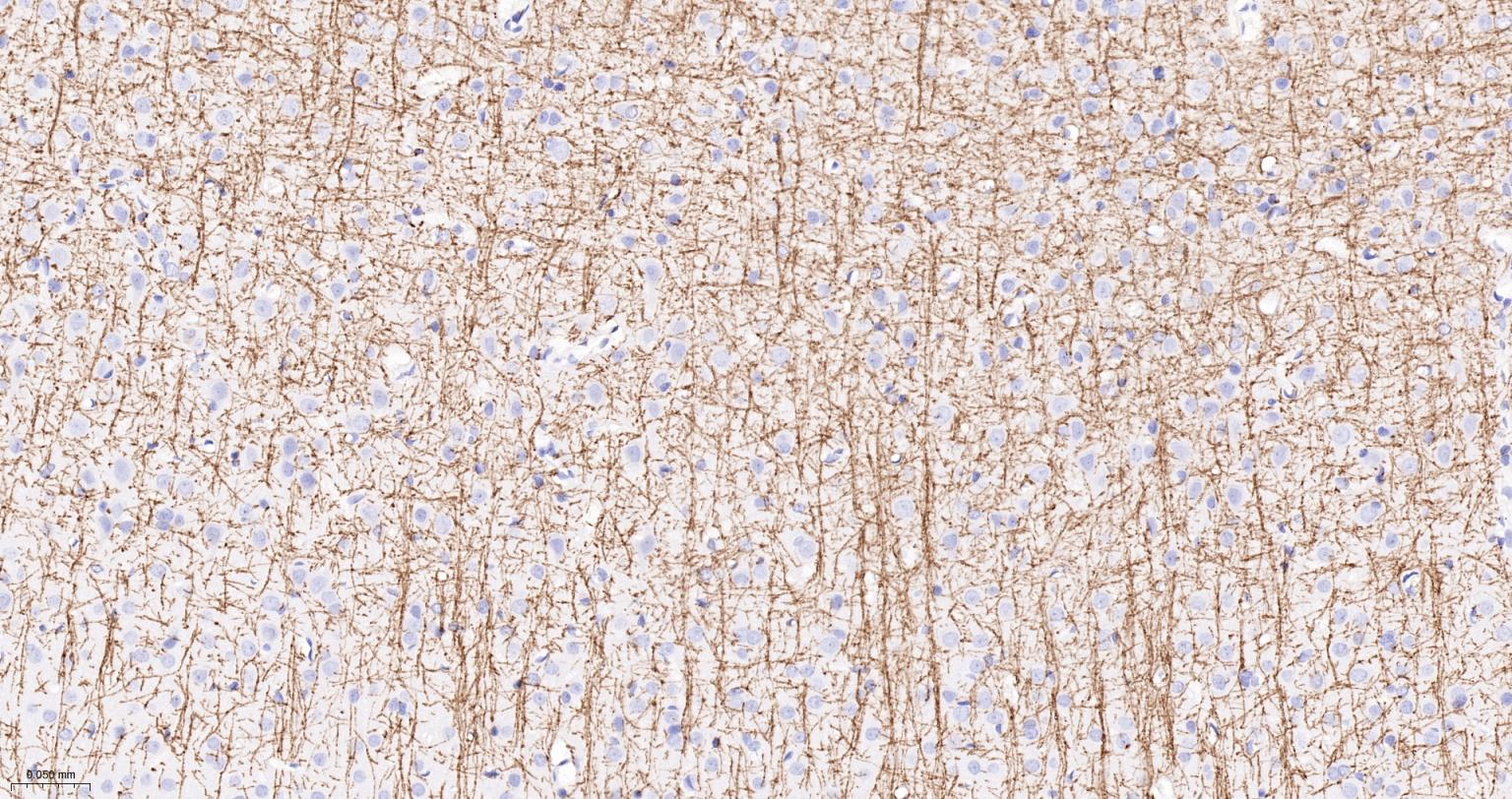 髓鞘碱性蛋白/磷脂碱性蛋白单克隆抗体-bsm-33932M