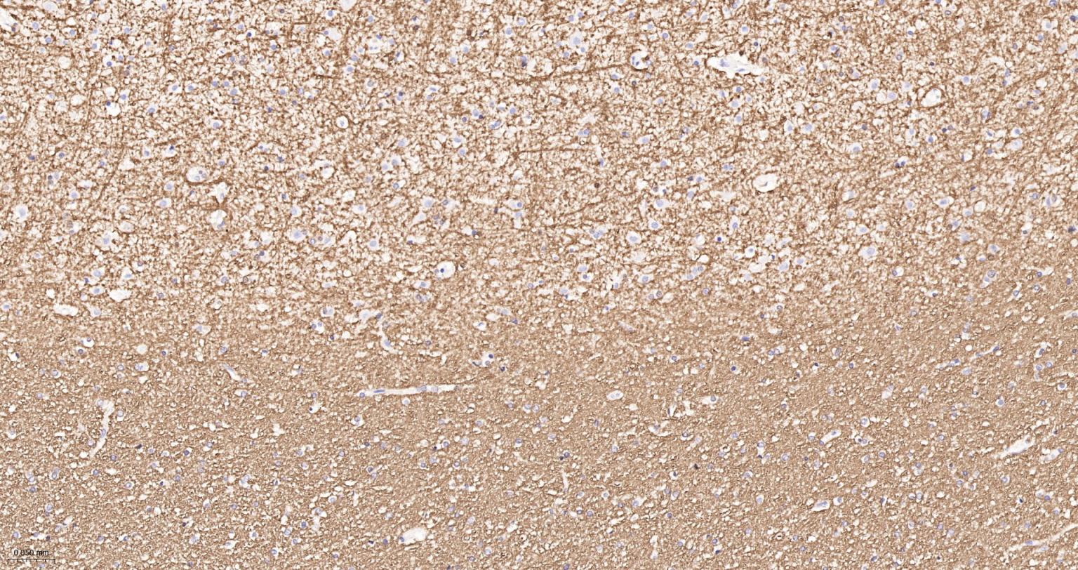 髓鞘碱性蛋白/磷脂碱性蛋白单克隆抗体-bsm-33932M