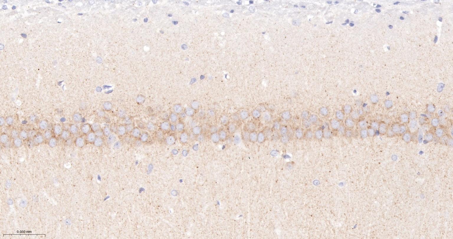 5-三磷酸肌醇受体1重组兔单抗