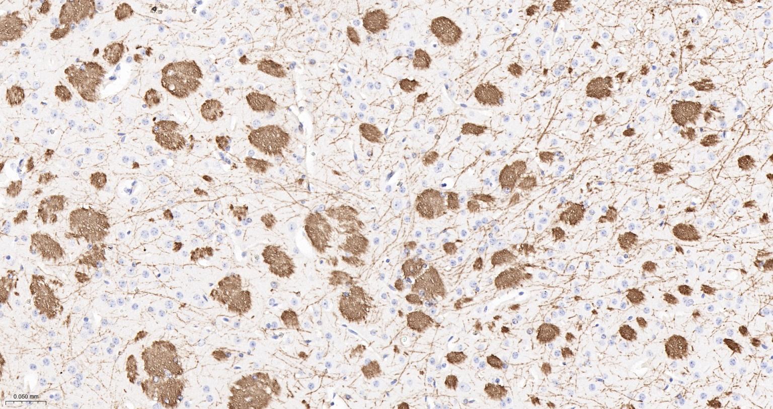 髓鞘碱性蛋白/磷脂碱性蛋白单克隆抗体-bsm-33932M