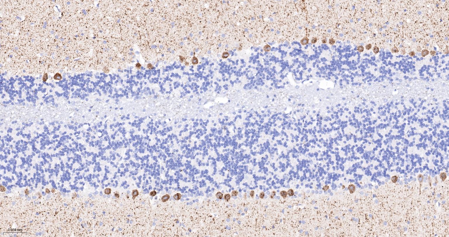 5-三磷酸肌醇受体1重组兔单抗