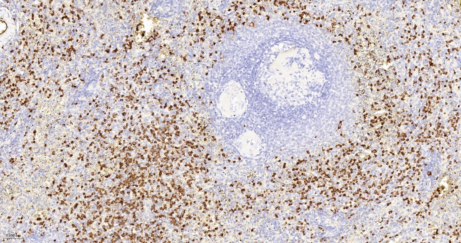 髓过氧化物酶重组兔单抗