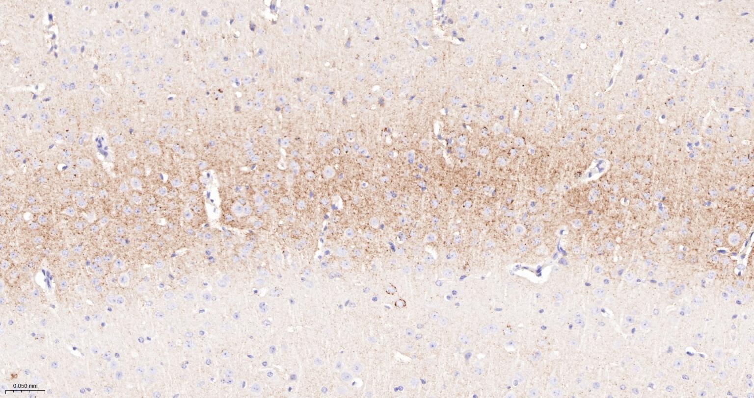 CD15/SSEA1重组兔单抗