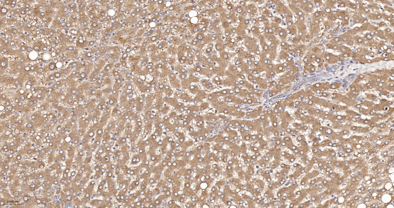 锌α2糖蛋白重组兔单抗