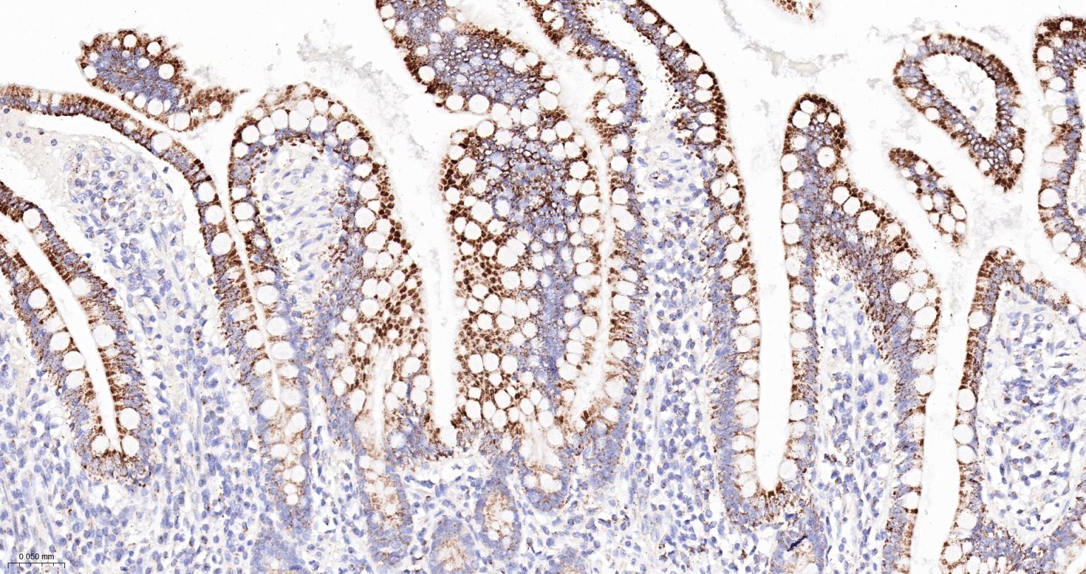 谷氨酰胺酶重组兔单抗