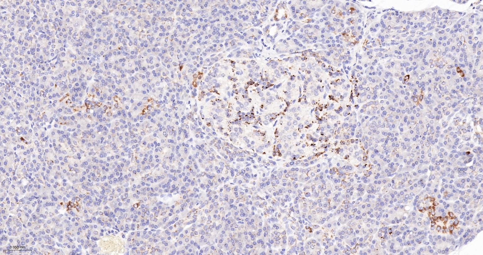 谷氨酰胺酶重组兔单抗