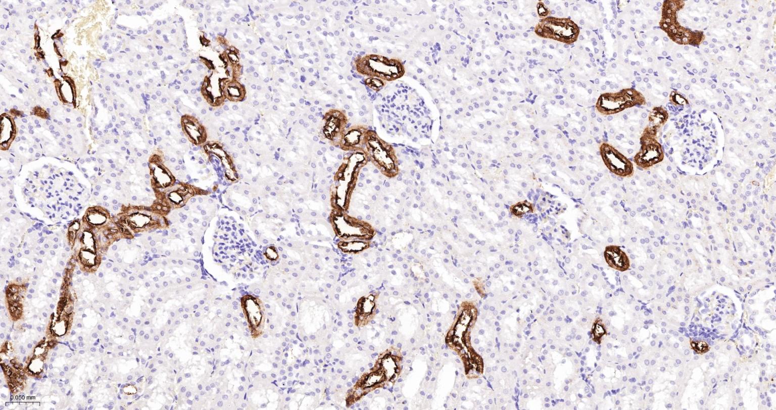 CD15/SSEA1重组兔单抗