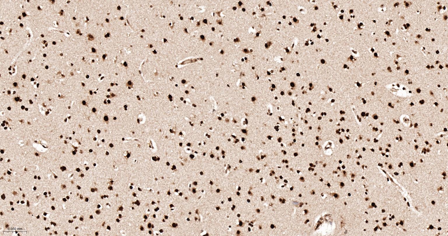 异质核糖核蛋白Q重组兔单抗
