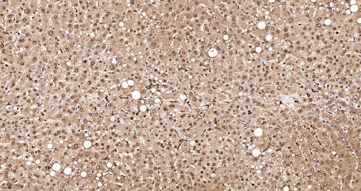 异质核糖核蛋白Q重组兔单抗