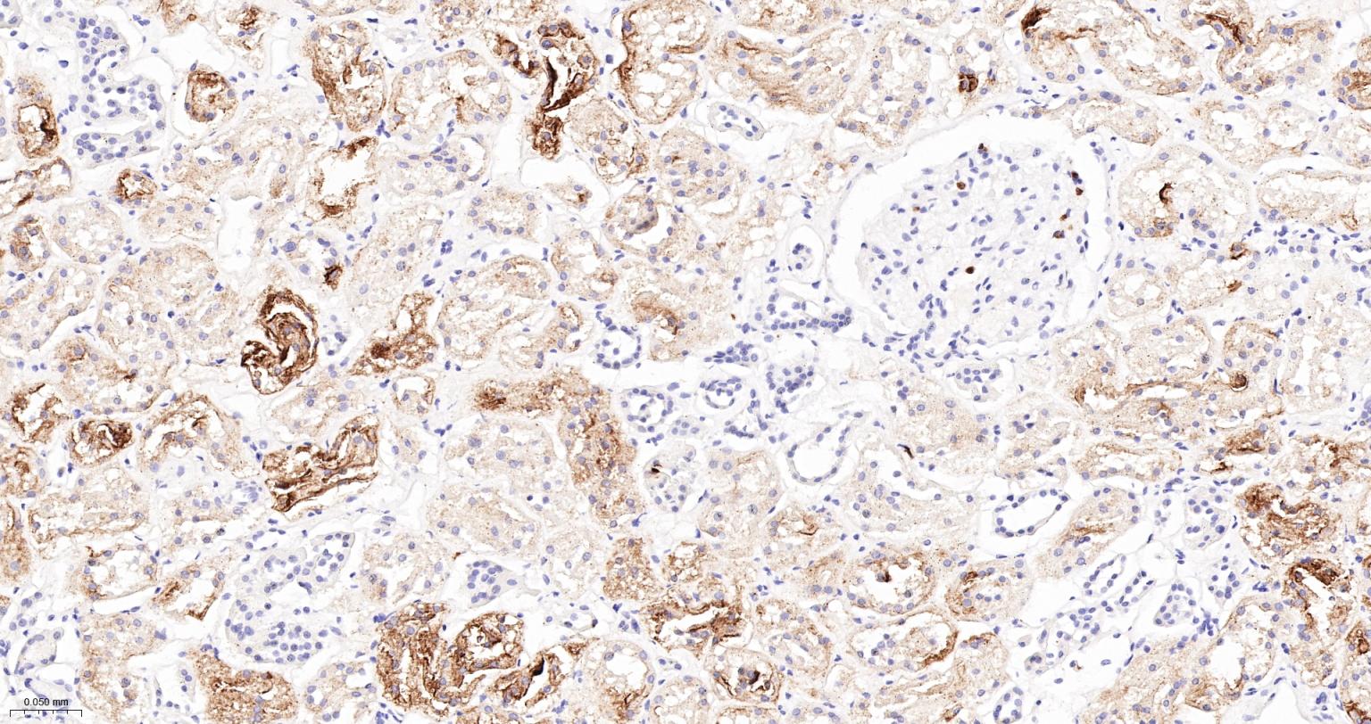 CD15/SSEA1重组兔单抗