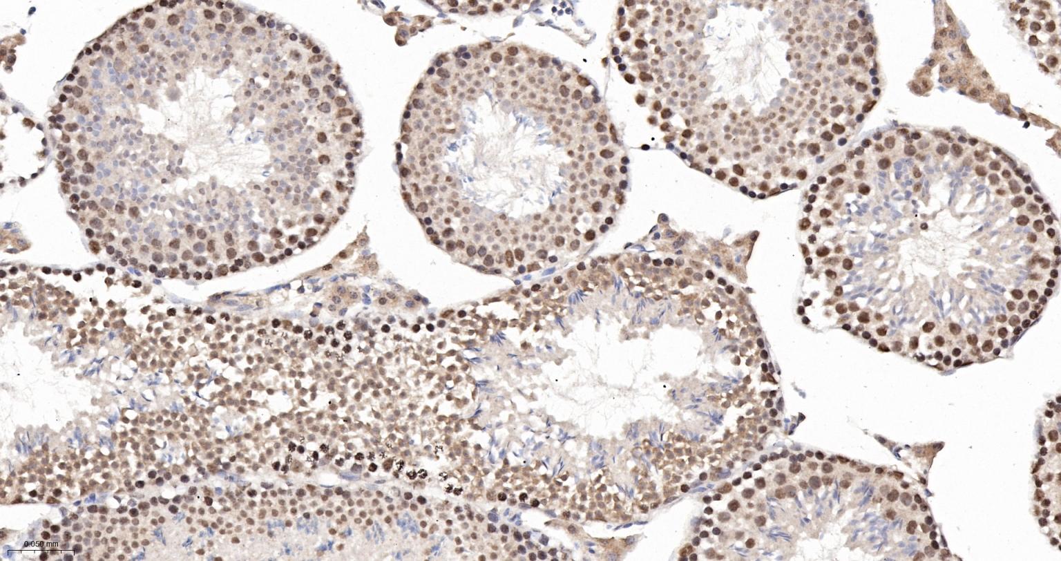 异质核糖核蛋白Q重组兔单抗