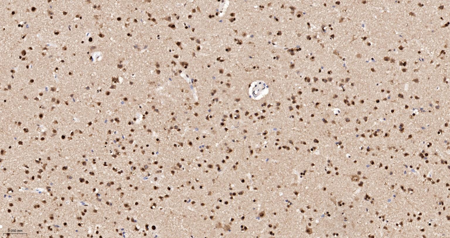 异质核糖核蛋白Q重组兔单抗