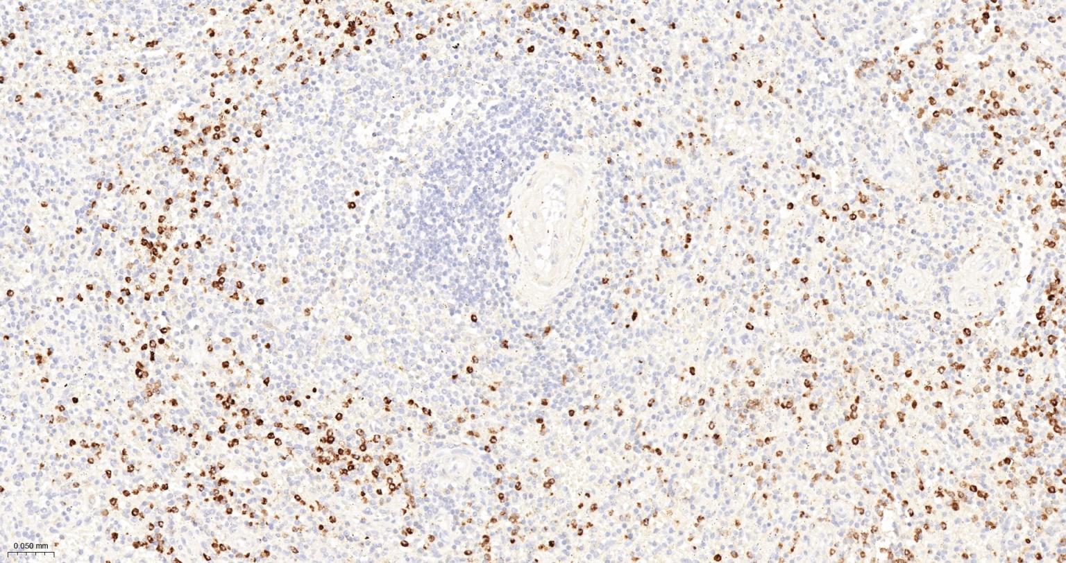 CD15/SSEA1重组兔单抗