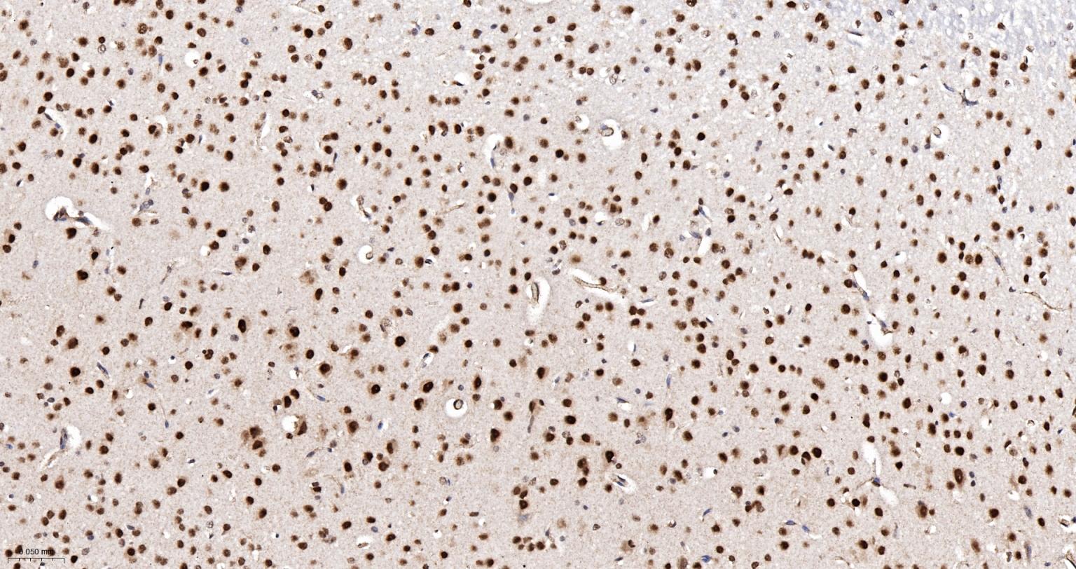 异质核糖核蛋白Q重组兔单抗