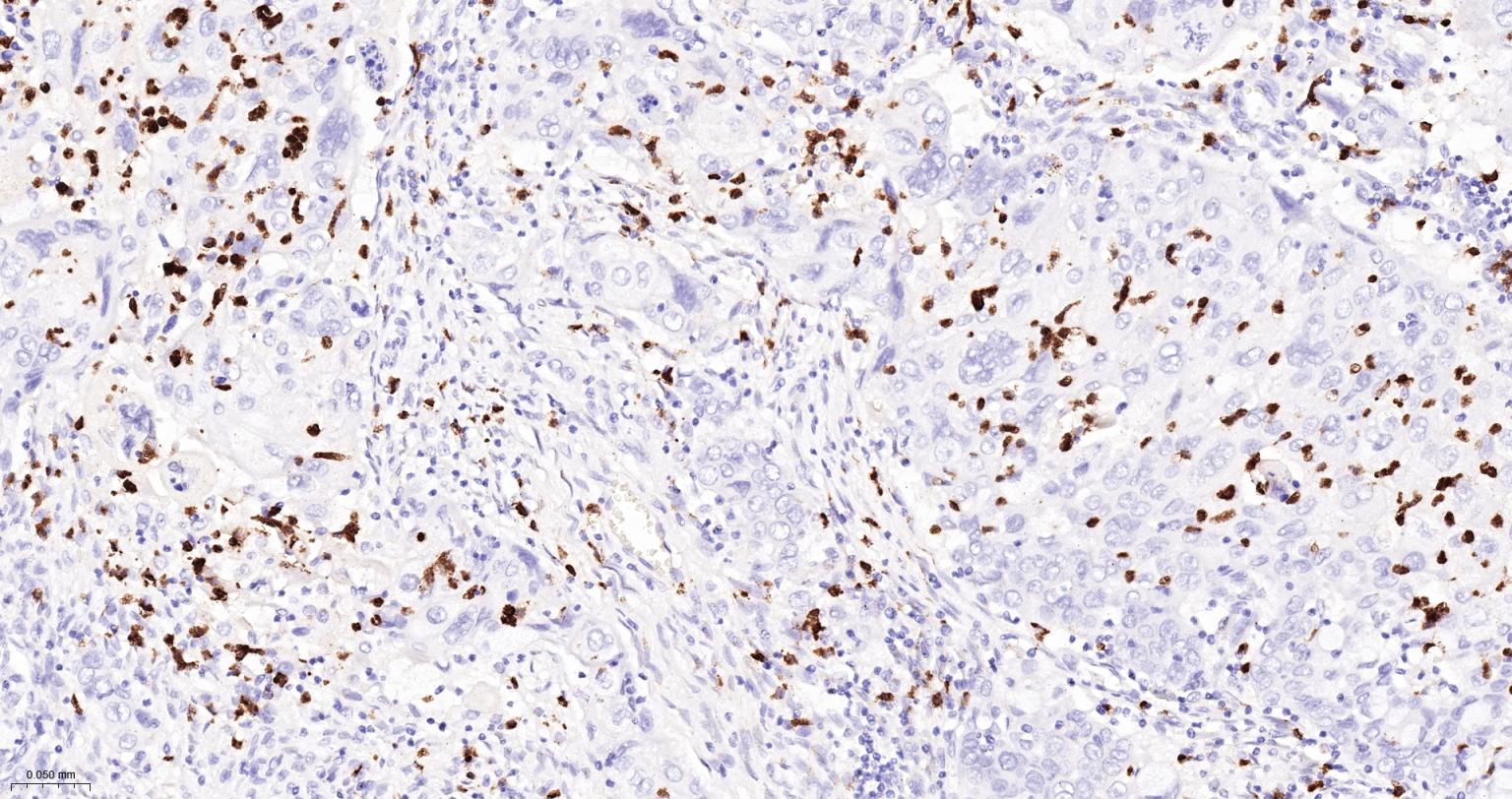 CD15/SSEA1重组兔单抗